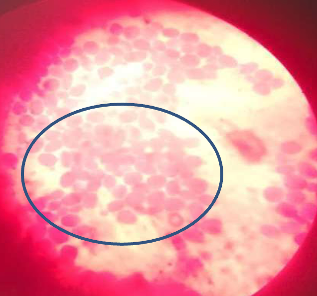 Figure 3: Microscopic view of the Kluyveromyces marxianus showing the yeast buds circled