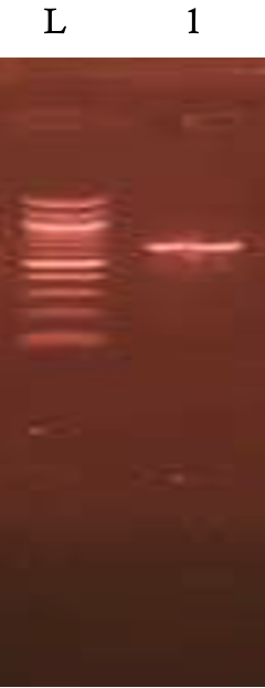 Figure 4: Agarose gel electrophoresis showing the amplified ITS. Lane 1 represent the amplified 650bp while lane L represents the 100bp DNA ladder