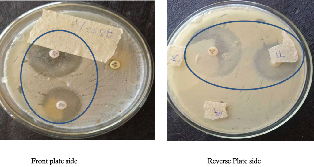 Figure 6: Antibiotic sensitivity test plates on Kluyveromyces marxianus isolated from the skin lesion (Zones of inhibition circled)